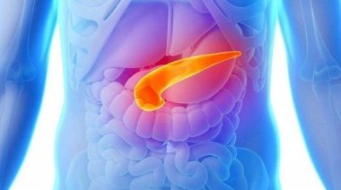 ¿Qué es el Síndrome de Quilomicronemia Familiar?