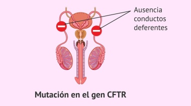 Mutaciones en la Fibrosis Quística: Un Detalle del Gen CFTR