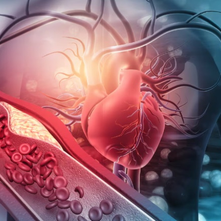 Colesterol alto en la mitad de los argentinos: sedentarismo y sobrepeso entre los principales factores de riesgo